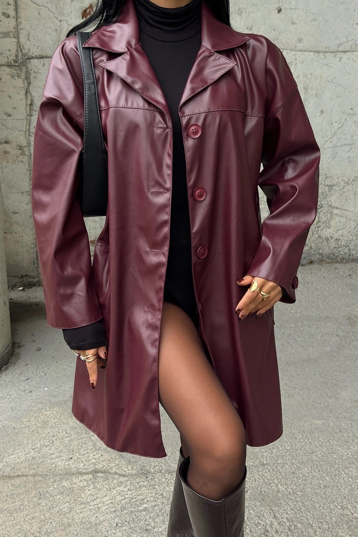 Cherry Button Detail Trench Coat